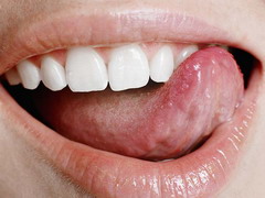 Zdravé zuby zvyšují uplatnění